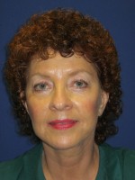 FACEology Lift / Neck Lift