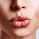 Lip Augmentation