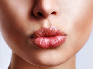 Lip Augmentation