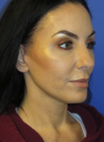 FACEology Lift / Neck Lift