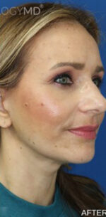 FACEology Lift / Neck Lift