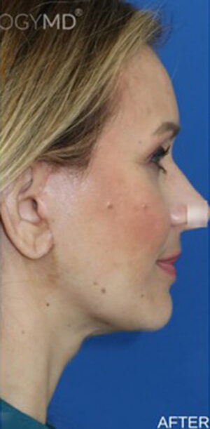 FACEology Lift / Neck Lift