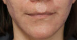 FACEology Lift / Neck Lift