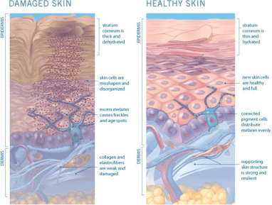 damaged-skin