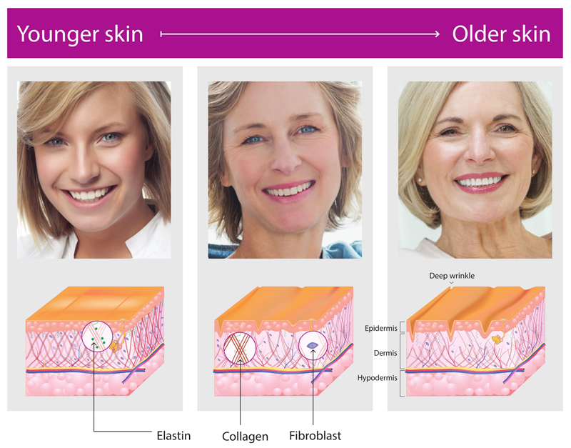 Skin Aging Progression Infographic
