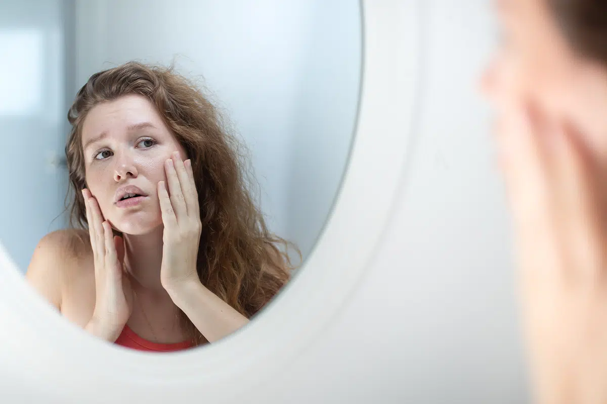 anxious young woman look in the mirror worried about wrinkle or acne on unhealthy skin