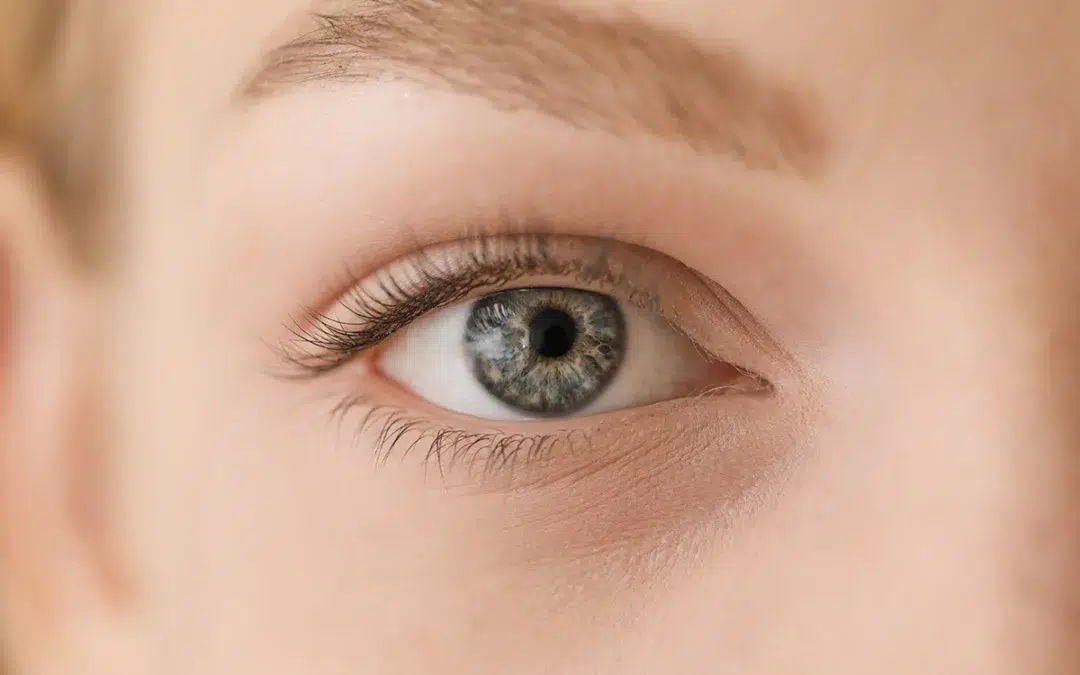 What Is Latisse Used For?