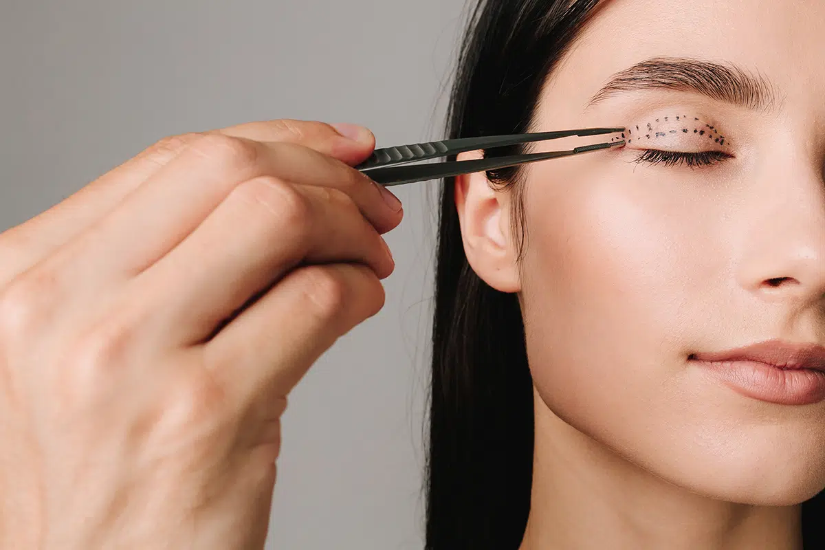 blepharoplasty markup close up on the face before the plastic surgery operation for modifying the eye region of the face