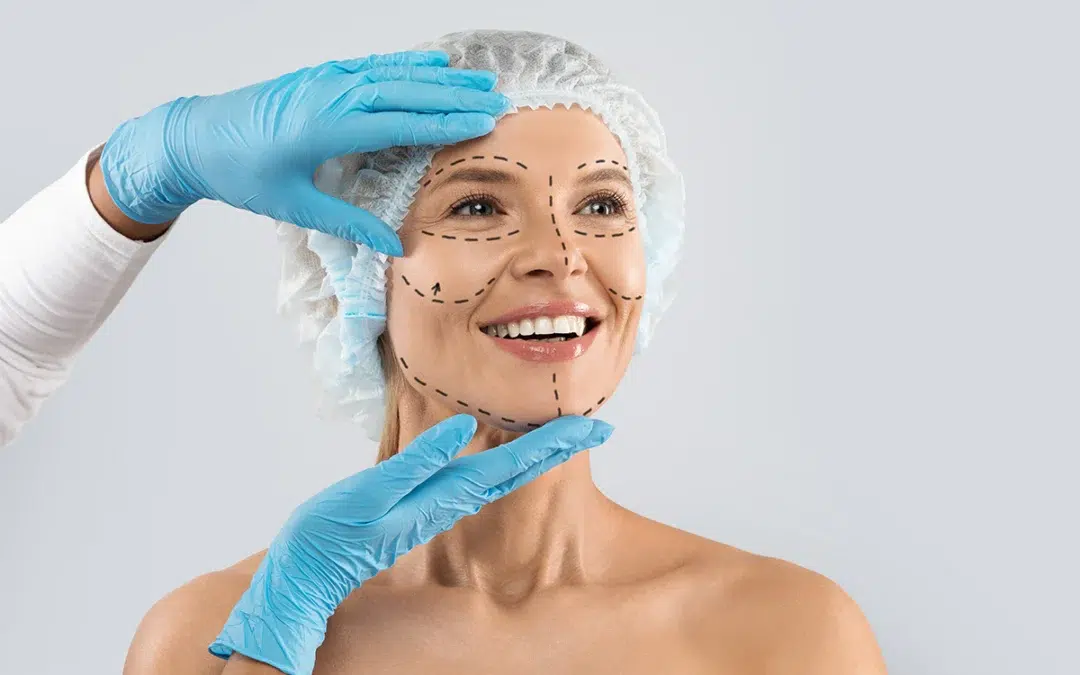 Rhytidectomy — Facelift Consultation Newport Beach