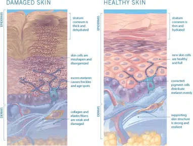 damaged skin infographics