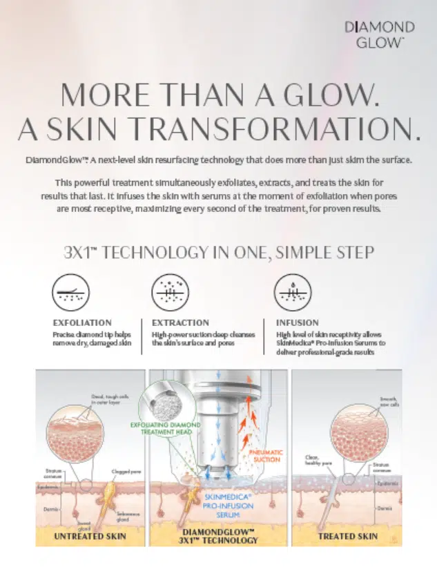 diamondglow clinical leave behind graphic