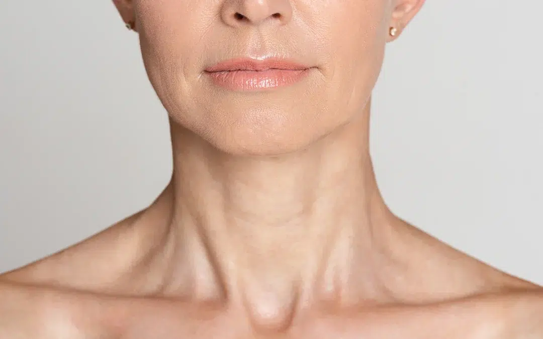 We Can Tighten Your Sagging Neck Skin