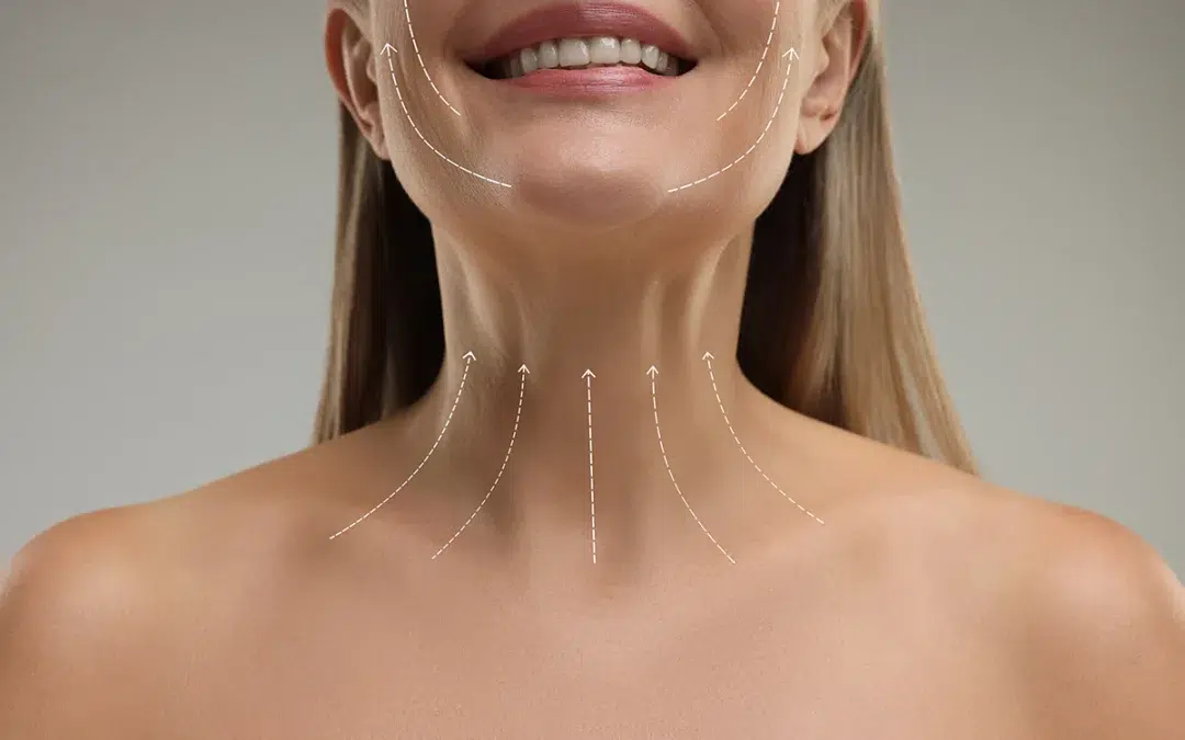 Neck Lift — Newport Beach Tightening Surgery