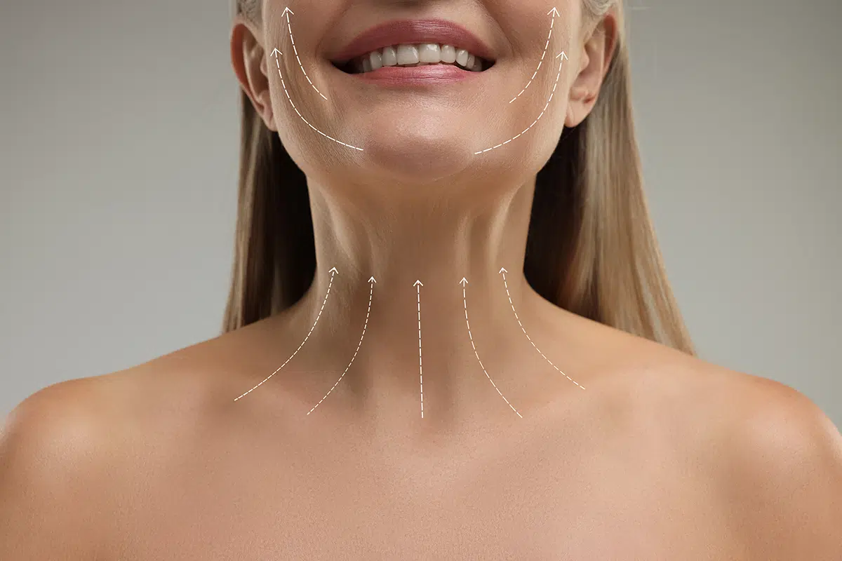 lifting arrows on womans neck and face