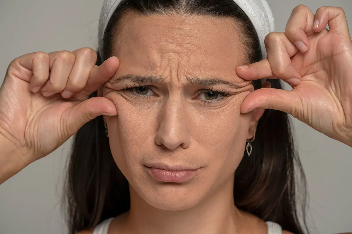 portrait of a young sad woman pinching her wrinkles next to her eyes