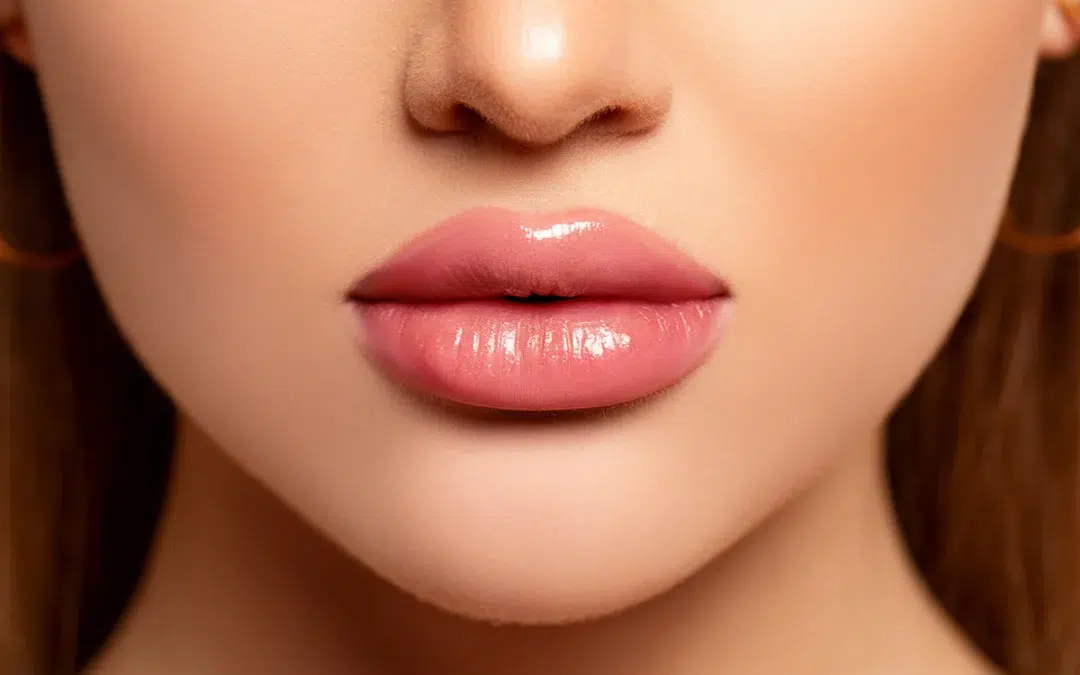 Benefits of Juvederm® for Plumper Lips