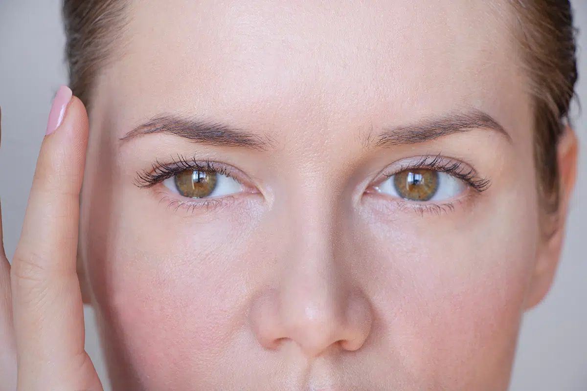 woman face and drooping eyelid
