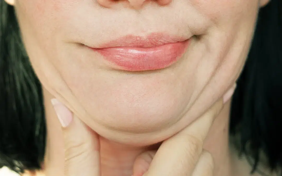 Want to get rid of that double chin?