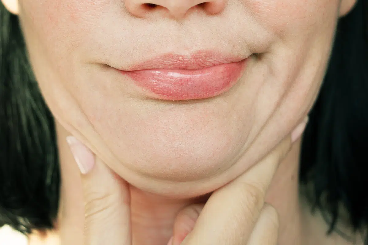 woman with a second chin