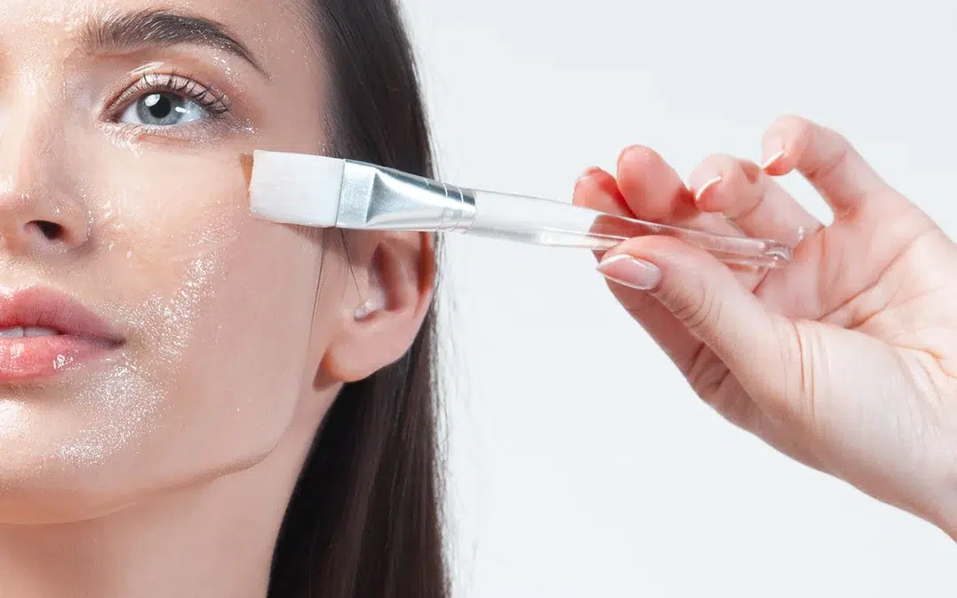 Coming In for Your First TCA Chemical Peel